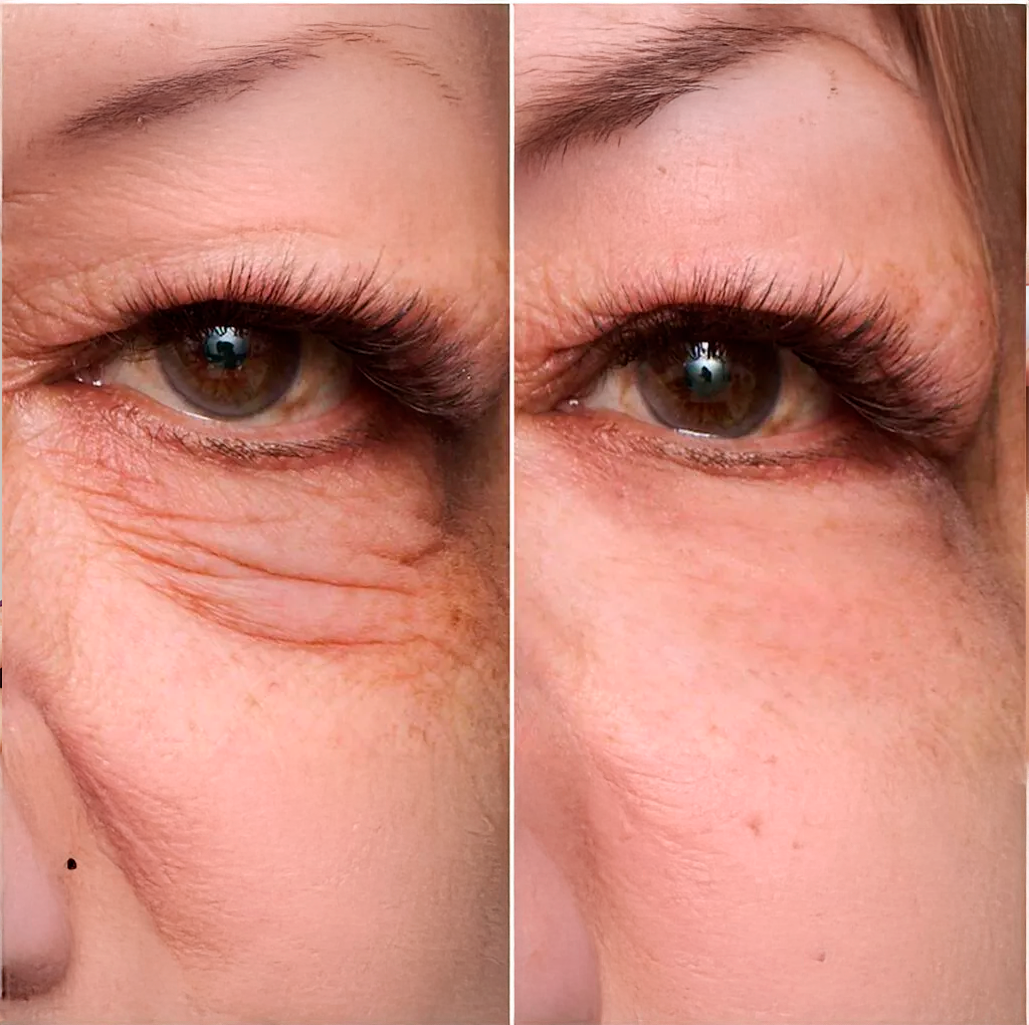 Calcium Volume Collagen Stick