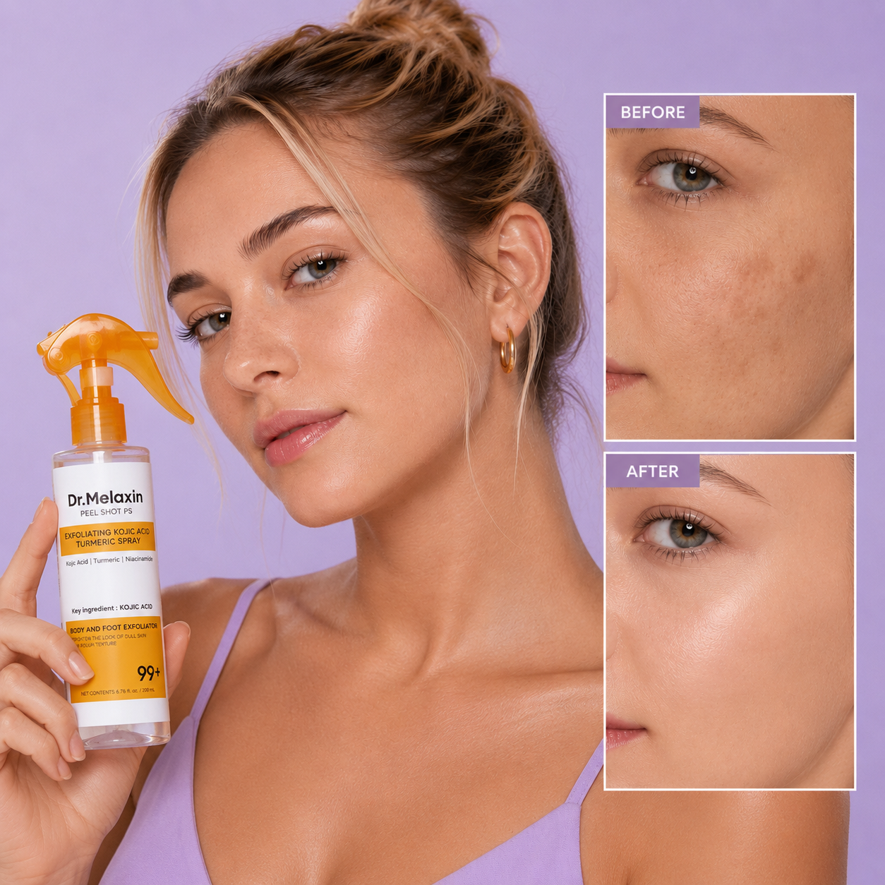 Peel Shot Keratin Care Kojic Acid