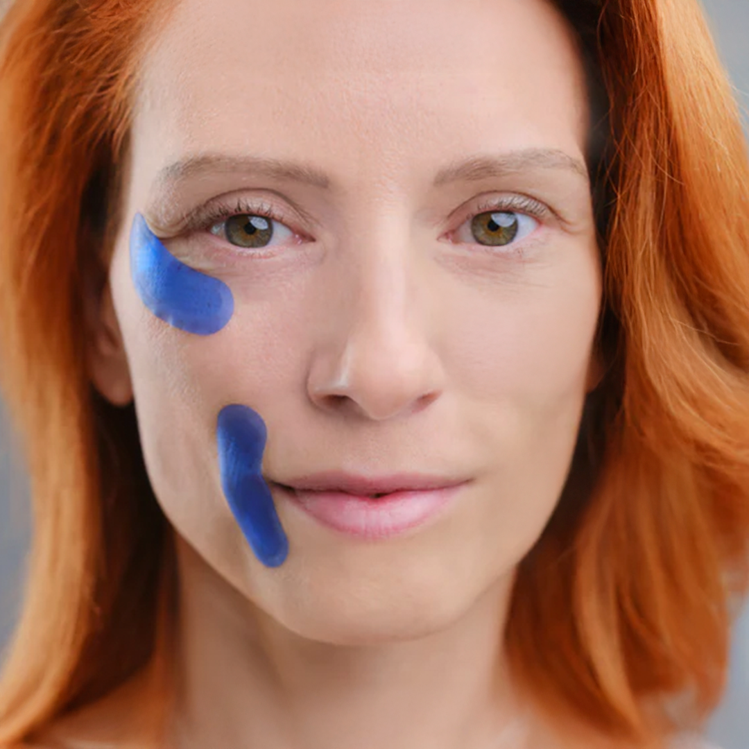 Qure Micro-Infusion Targeted Patches